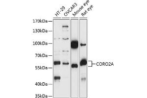 Western blot analysis of extracts of various cell lines, using CORO2A antibody (ABIN7266508) at 1:1000 dilution. (CORO2A 抗体  (AA 376-525))