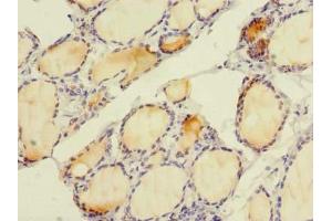 Immunohistochemistry (IHC) image for anti-Solute Carrier Family 4, Sodium Bicarbonate Cotransporter, Member 8 (SLC4A8) (AA 1-300) antibody (ABIN7151506)
