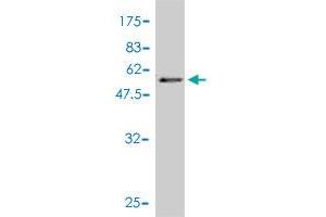 Western Blotting (WB) image for anti-Phosphoserine Phosphatase (PSPH) (AA 1-225) antibody (ABIN562501)