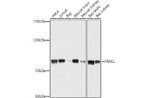 Western blot analysis of extracts of various cell lines, using PI antibody (ABIN6128448, ABIN6145592, ABIN6145594 and ABIN6214191) at 1:1000 dilution. (PIAS1 抗体  (AA 422-651))