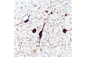 Immunohistochemistry (IHC) image for anti-Parvalbumin (PVALB) antibody (ABIN7269182)