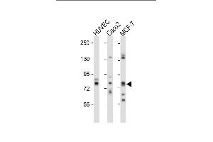 All lanes : Anti-cGKII Antibody (C-term) at 1:1000 dilution Lane 1: HUVEC whole cell lysate Lane 2: Caco2 whole cell lysate Lane 3: MCF-7 whole cell lysate Lysates/proteins at 20 μg per lane. (PRKG2 抗体  (C-Term))