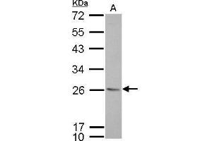 WB Image CD74 antibody [N1N2], N-term detects CD74 protein by Western blot analysis. (CD74 抗体  (N-Term))