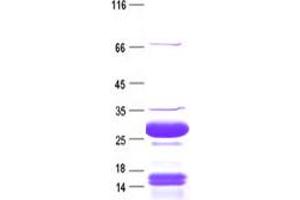 Western Blotting (WB) image for Gastrin-Releasing Peptide (GRP) (Transcript Variant 3) protein (His-ABP Tag) (ABIN2721717)