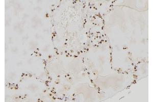 ABIN6264139 and ABIN6277592 at 1/100 staining Human lung tissue by IHC-P. (PER3 抗体  (Internal Region))