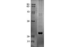 Western Blotting (WB) image for Z-DNA Binding Protein 1 (ZBP1) (Transcript Variant 1) protein (His tag) (ABIN2735767)