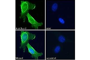 ABIN570923 Immunofluorescence analysis of paraformaldehyde fixed 3T3-L1 cells, permeabilized with 0. (TREM2 抗体  (Internal Region))