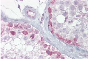 Anti-SYCP1 antibody IHC staining of human testis. (SYCP1 抗体  (AA 72-121))