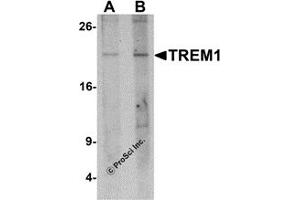 Western Blotting (WB) image for anti-Triggering Receptor Expressed On Myeloid Cells 1 (TREM1) (N-Term) antibody (ABIN1077426) (TREM1 抗体  (N-Term))