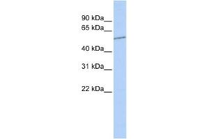 Western Blotting (WB) image for anti-Solute Carrier Family 39 (Zinc Transporter), Member 7 (SLC39A7) (N-Term) antibody (ABIN2781567)