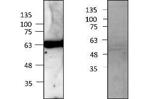 WT1 Protein (AA 1-449) (Strep Tag)