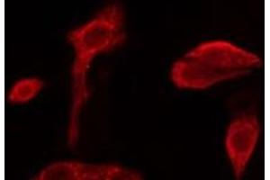 ABIN6279673 staining NIH-3T3 cells by IF/ICC. (PABPC3 抗体)