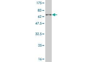 Western Blot detection against Immunogen (57. (DLX3 抗体  (AA 1-287))
