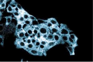 Immunofluorescent staining of HepG2 cells with anti-ALDH. (Aldehyde Dehydrogenase 抗体  (AA 7-128))