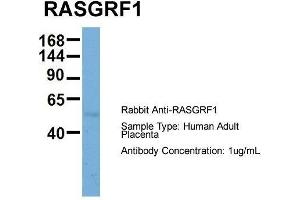 Host: Rabbit  Target Name: RASGRF1  Sample Tissue: Human Adult Placenta  Antibody Dilution: 1. (RASGRF1 抗体  (Middle Region))