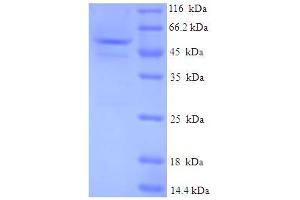 SDS-PAGE (SDS) image for Guanosine Monophosphate Reductase (GMPR) (AA 1-345), (full length) protein (His-SUMO Tag) (ABIN5710926)