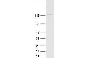 RANBP6 Protein (Transcript Variant 1) (Myc-DYKDDDDK Tag)