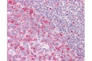 Anti-PELI1 / Pellino 1 antibody IHC staining of human tonsil. (Pellino 1 抗体  (C-Term))