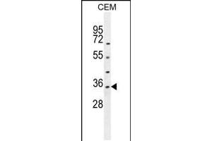 Western blot analysis in CEM cell line lysates (35ug/lane). (LDHAL6A 抗体  (AA 154-183))