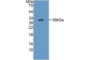 Detection of Recombinant NOTCH2NL, Human using Polyclonal Antibody to Notch2 N-Terminal Like Protein (NOTCH2NL) (NOTCH2NL 抗体  (AA 1-236))