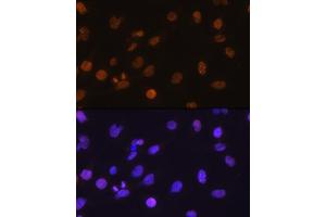 Immunofluorescence analysis of C6 cells using DDIT3/CHOP antibody (ABIN3020709, ABIN3020710, ABIN3020711, ABIN1512759 and ABIN6213685) at dilution of 1:100.