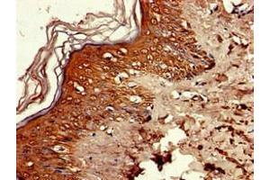 Immunohistochemistry of paraffin-embedded human skin tissue using ABIN7168111 at dilution of 1:100 (RNASEH2C 抗体  (AA 1-164))