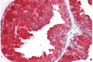 Image no. 2 for anti-Acid Phosphatase, Prostate (ACPP) (AA 269-282) antibody (ABIN1493860) (ACPP 抗体  (AA 269-282))