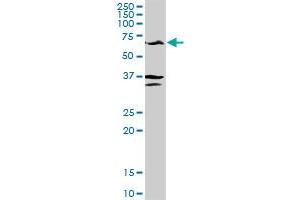 GPT MaxPab rabbit polyclonal antibody. (ALT 抗体  (AA 1-496))