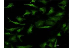 Immunofluorescence of monoclonal antibody to GIF on HeLa cell. (Intrinsic Factor 抗体  (AA 318-417))
