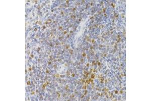 Immunohistochemistry (Paraffin-embedded Sections) (IHC (p)) image for anti-Nuclear Autoantigenic Sperm Protein (Histone-Binding) (NASP) (AA 180-449) antibody (ABIN6144374)