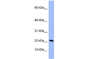WB Suggested Anti-PIN4  Antibody Titration: 0. (PIN4 抗体  (Middle Region))