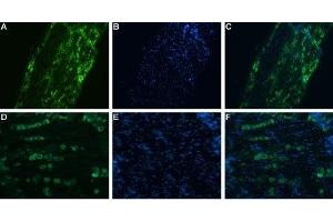 SCN11A 抗体  (C-Term, Intracellular)