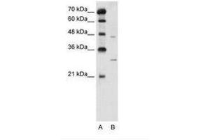 Image no. 2 for anti-Solute Carrier Family 36 (Proton/amino Acid Symporter), Member 3 (SLC36A3) (N-Term) antibody (ABIN205028) (SLC36A3 抗体  (N-Term))