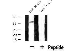 Western blot analysis of extracts from rat brain, using CDKL4 Antibody. (CDKL4 抗体  (Internal Region))