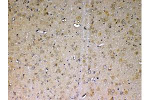 IHC analysis of ADA using anti-ADA antibody .