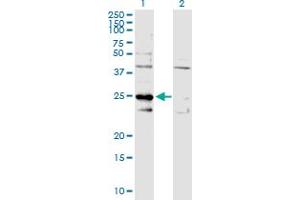 Western Blotting (WB) image for C1QBP 293T Cell Transient Overexpression Lysate(Denatured) (ABIN1331099)