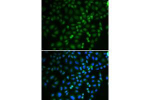 Immunofluorescence analysis of U2OS cells using TRIM21 antibody. (TRIM21 抗体)