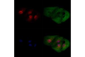 ABIN6258361 and ABIN6274539 staining  cells by IF/ICC.