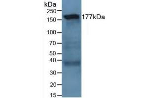 Detection of LAMC1 in Human Lung Tissue using Polyclonal Antibody to Laminin Gamma 1 (LAMC1) (Laminin gamma 1 抗体  (AA 521-772))