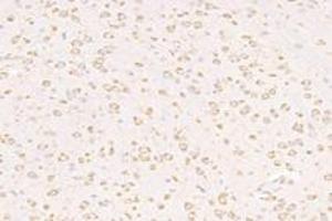 Immunohistochemistry analysis of paraffin-embedded mouse substantia nigra using VPS13B (ABIN7076176) at dilution of 1: 2000 (VPS13B 抗体)