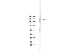 anti-Zinc Finger and BTB Domain Containing 40 (ZBTB40) (Internal Region) antibody