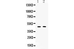 Western blot analysis of SERPINA5 expression in rat liver extract ( Lane 1) and SKOV3 whole cell lysates ( Lane 2).