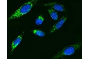 IF analysis of ATP5F1B using anti-ATP5F1B antibody (ABIN7599866). (Atp5f1b (AA 123-529) 抗体)