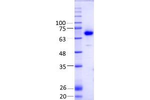 SMOX (AA 1 - 555), Fraction 14 (SMOX Protein (AA 1-555) (Strep Tag))