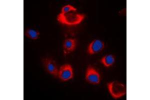 Immunofluorescent analysis of BAX staining in HeLa cells. (BAX 抗体  (Center))