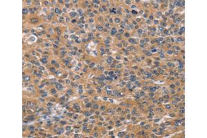 Immunohistochemistry (IHC) image for anti-Natural Cytotoxicity Triggering Receptor 2 (NCR2) antibody (ABIN2432791) (NKp44/NCR2 抗体)