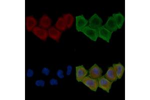 ABIN6260477 and ABIN6276706 staining Hela cells(30 min of UV treatment) by IF/ICC.
