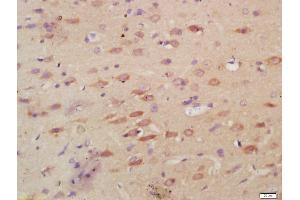 Formalin-fixed and paraffin embedded rat brain labeled with Anti-MPO Polyclonal Antibody, Unconjugated (ABIN1387491) at 1:200, followed by conjugation to the secondary antibody and DAB staining (Myeloperoxidase 抗体  (AA 678-745))