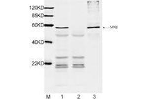 Lane1: 1 µL E-coli lysate with DYKDDDDK-tag protein (MW: 57 kDa) and 2 µg Mouse Anti-DYKDDDDK-tag Monoclonal Antibody (ABIN387700) for IP.