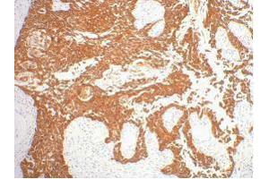 Immunohistochemistry (IHC) image for anti-Keratin 16 (KRT16) antibody (ABIN3181126)